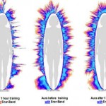 La photographie Kirlian, reflet de la santé bioélectrique